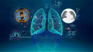 Lung cancer diagnosis focused on AI system 